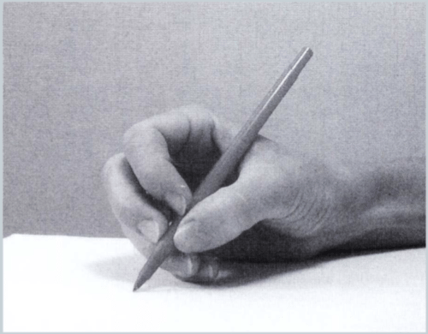 <p>3 fingered (thumb index and 3rd finger), control from the FOREARM</p>