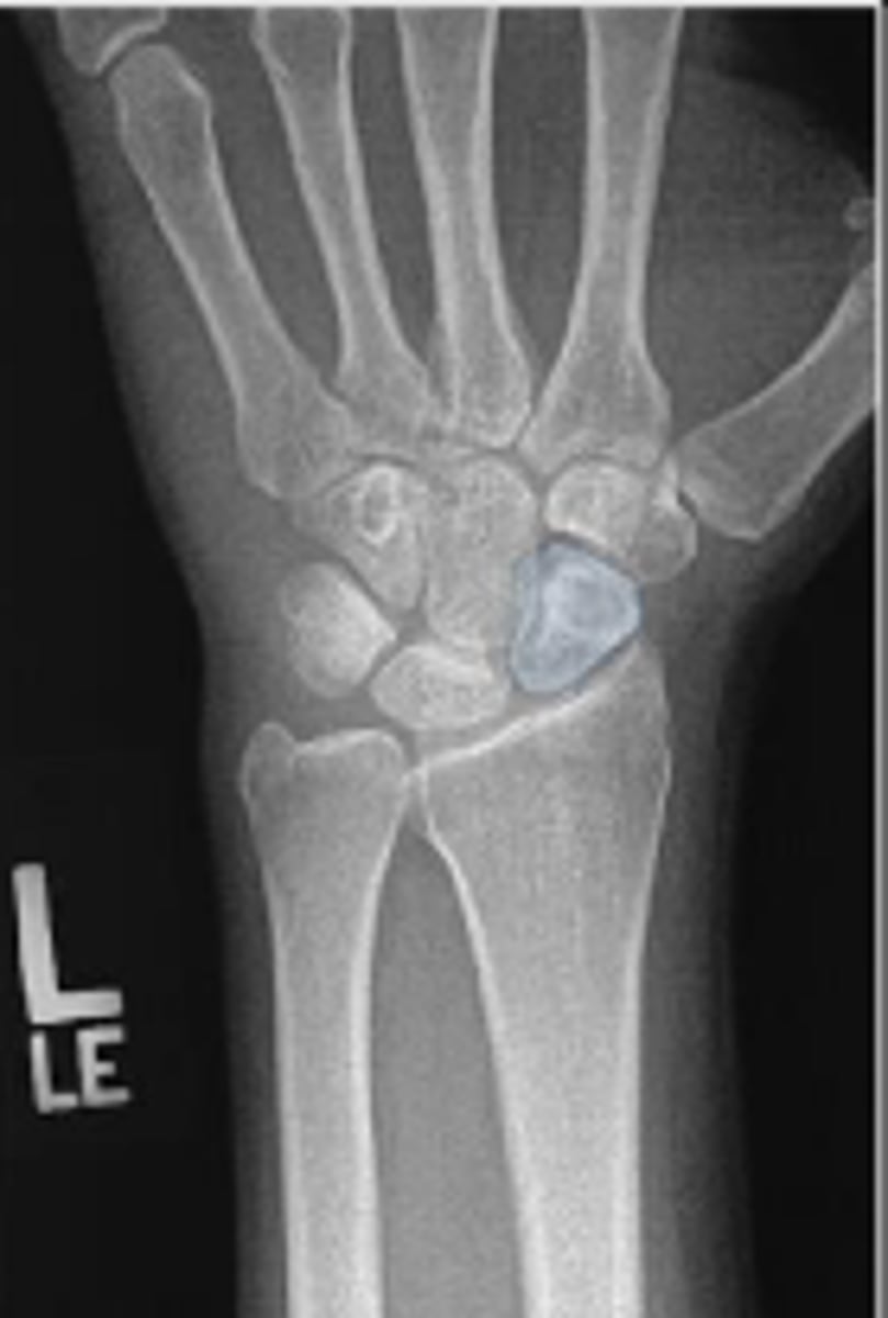 <p>What is outlined?</p>