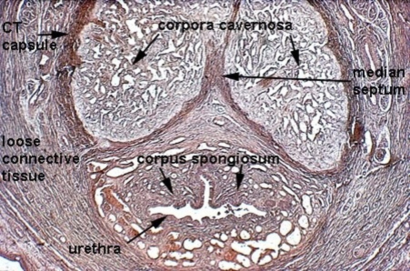 <p>The erectile tissue consist of lacunae, spaces filled with blood, surrounded by collagenous connective tissue (the tunica albuginea)</p>