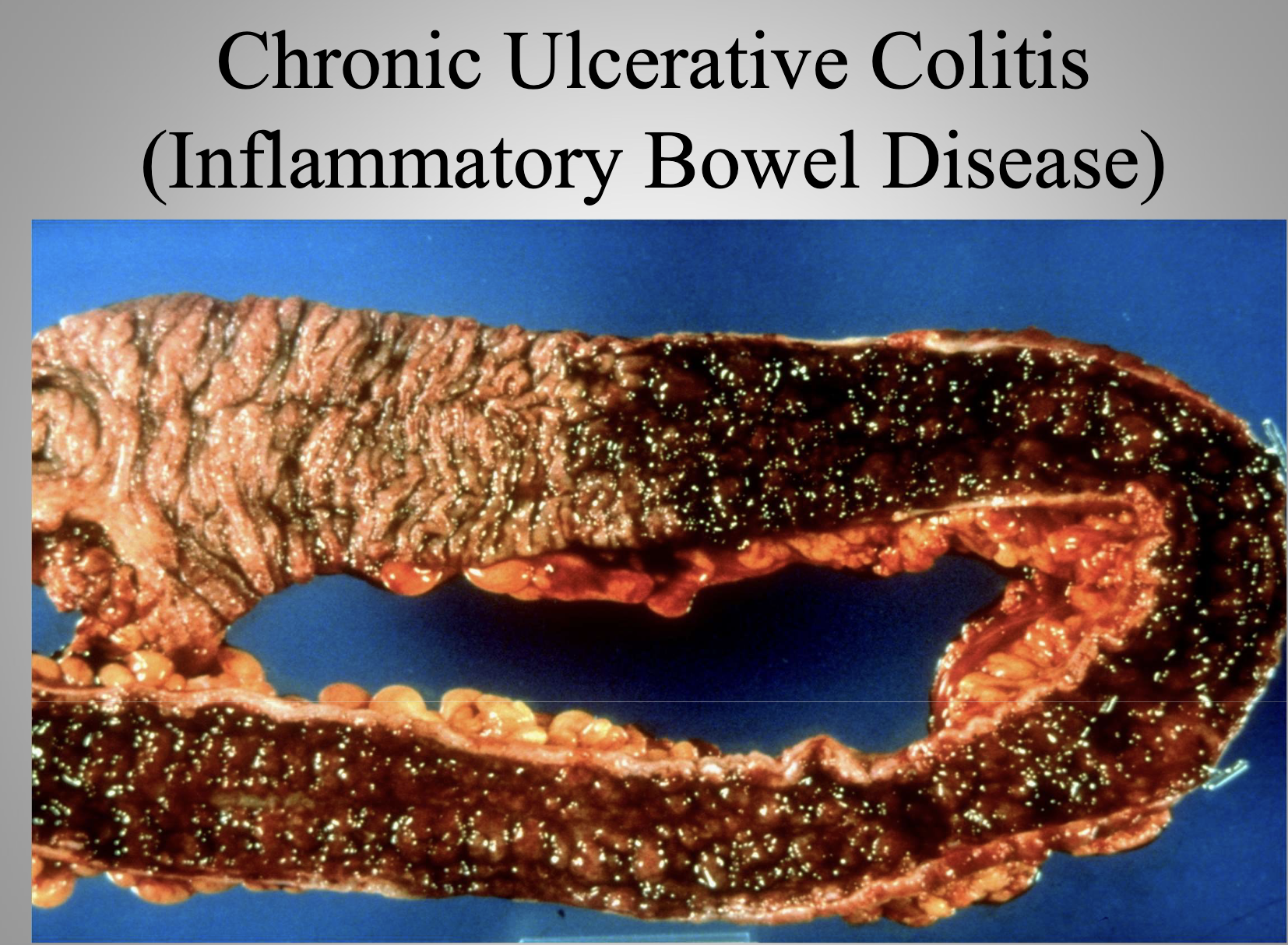 <p>Chronic Disease</p>