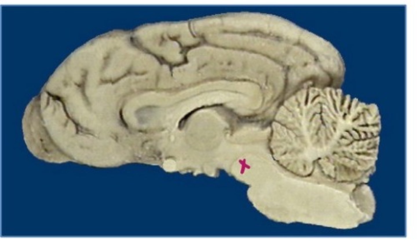 <p>brain stem (medullary tegmentum)</p>