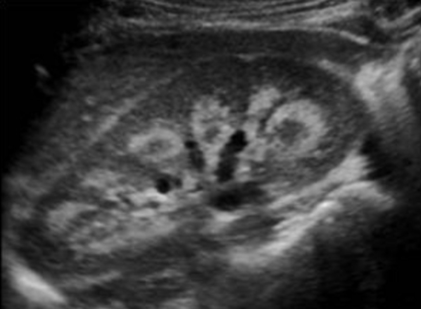 <p>calcium ; pyramids</p>