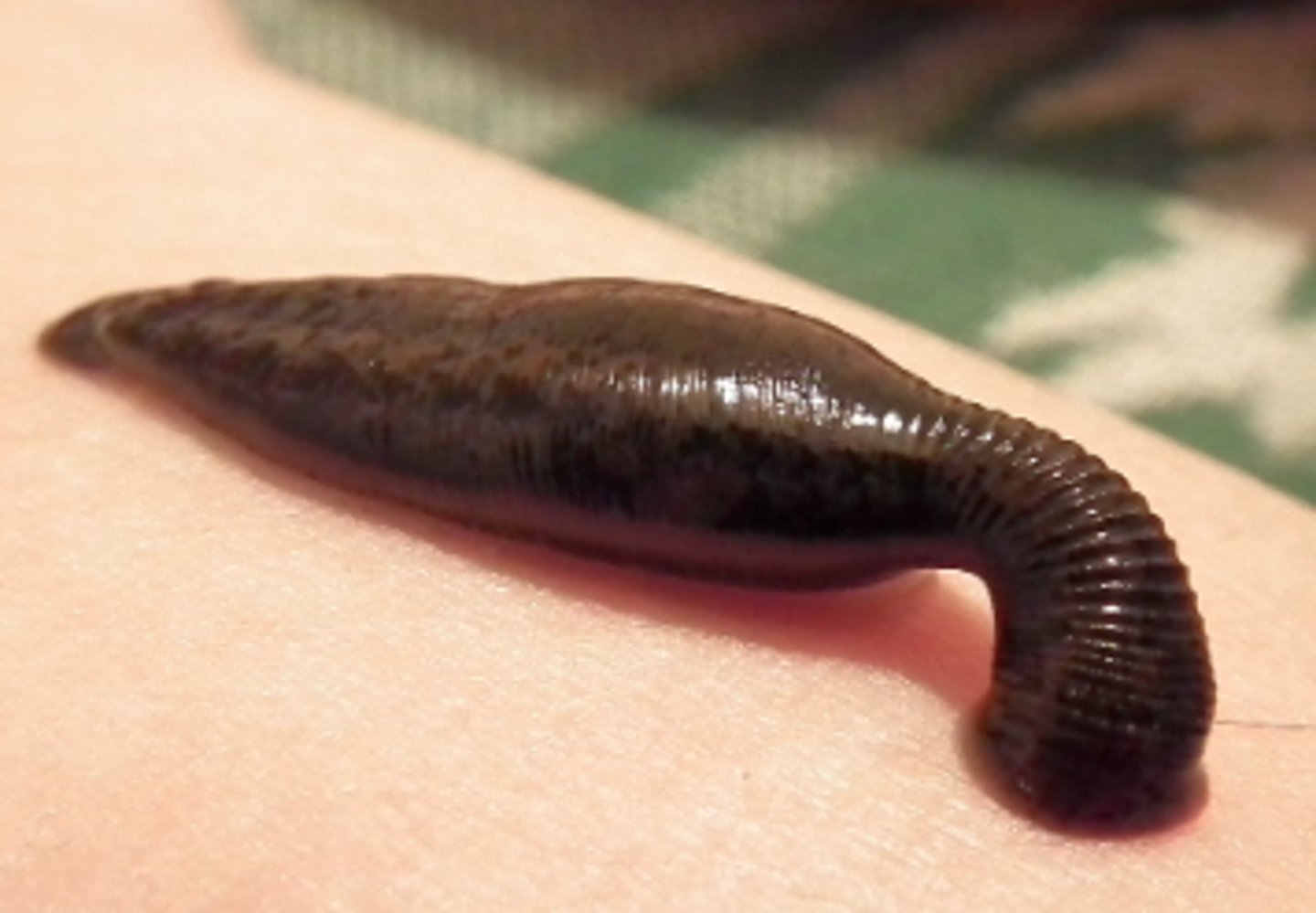 <p>Leeches have been used in medicine for over 2500 years! It is a natural form of bloodletting, and their saliva contains a natural anti-coagulant that anaesthetises the wound area reducing pain from their bite. It was believed in medieval times that leeches only removed "impure" blood from the body, leaving behind "good" blood - still used today</p>