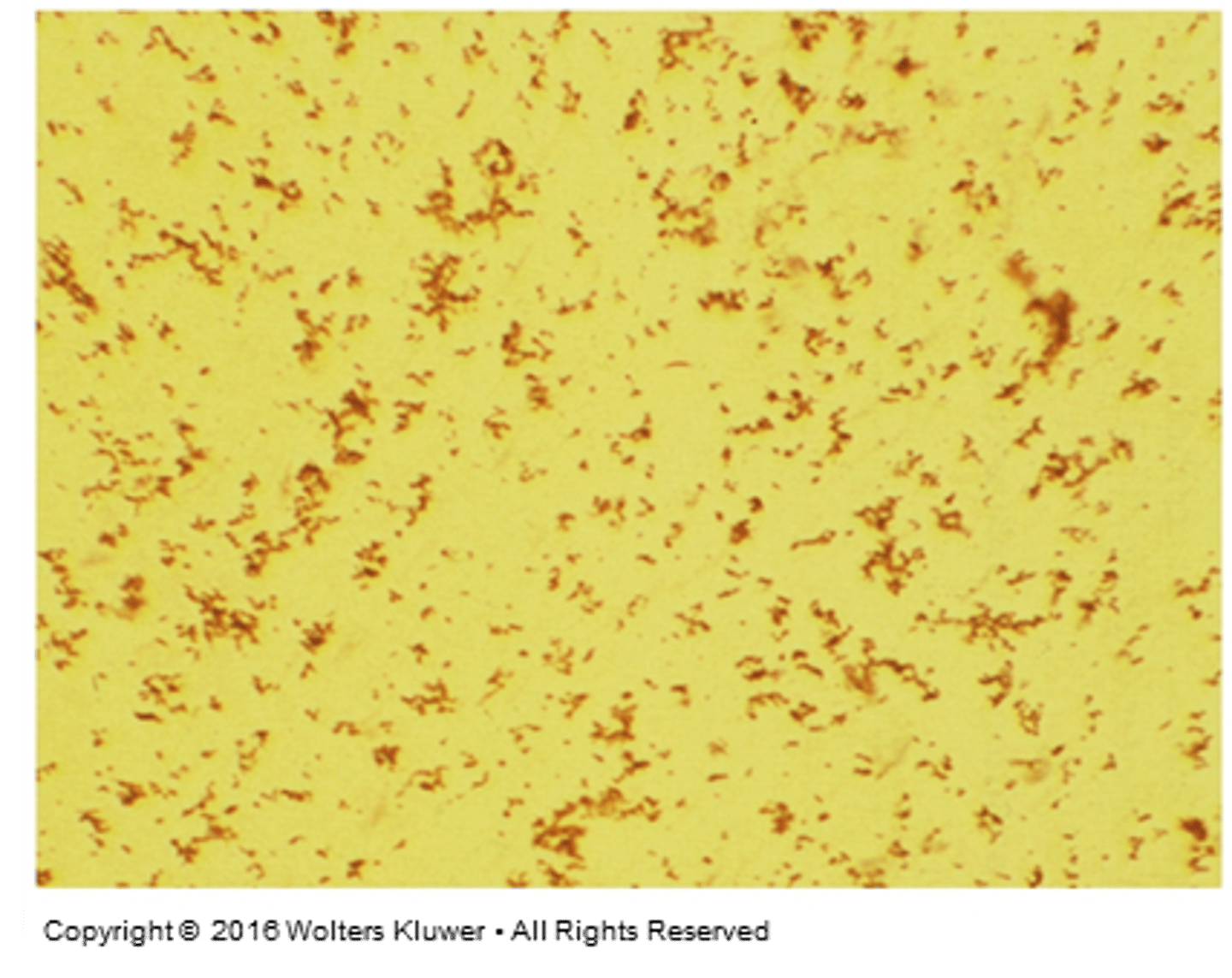 <p>What is this in urine</p>