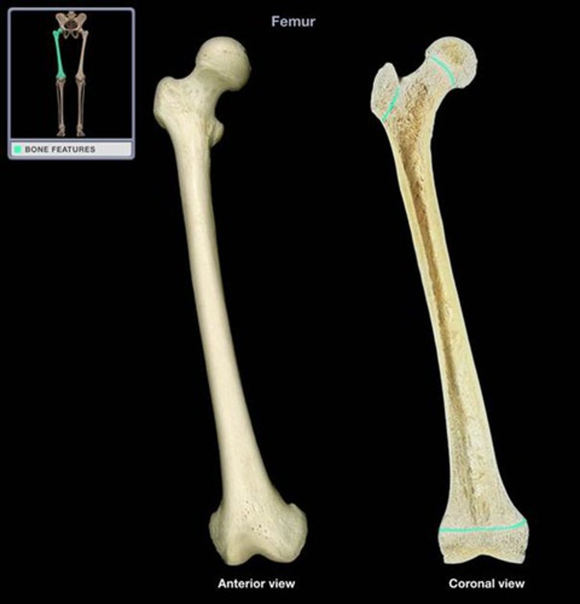 <p>Identify this highlighted part of a long bone.</p>