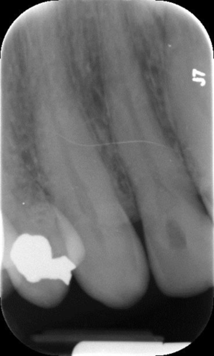 <p>What is this error?</p>