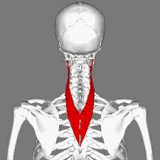 <p>Post neck</p><p>O: T3-T6</p><p>I: TP C1-C3</p><p>A: ext of C spine. Ipsilat bend/flex and rot</p>