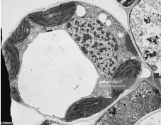 What type of cell is most likely shown below?

a. red blood cell 

b. muscle cell 

c. plant mesophyll cell 

d. nerve cell 

e. macrophage