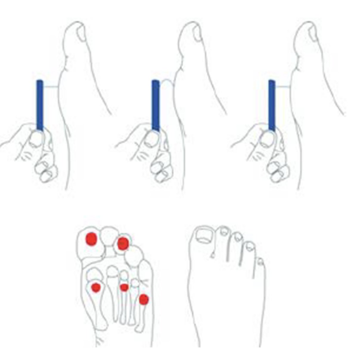 <p>skin exam, circulation (pulses), pinprick and&nbsp;vibratory sensation, temperature, achilles reflexes, and monofilament exam at every visit</p>