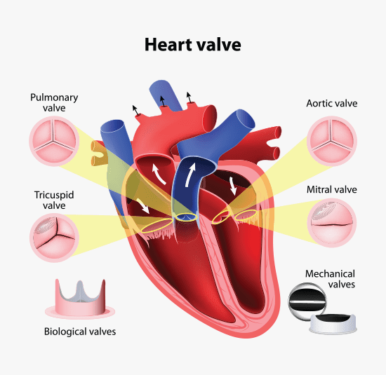 <p><strong>Causation</strong> - Sufficient Causal Link</p><p><u>Facts</u>: Mrs Ambros had an underlying condition (SCAD) giving rise to a risk of death. She had a heart attack (myocardial infarction) as a result of the underlying condition. She was admitted to hospital with chest pain. Mr Ambros’ consultant, Dr Hart, failed to observe reasonable skill, including failing to take a number of critical steps in the face of evidence of the heart attack.</p><p><u>Issue</u>: Whether, for the purposes of the ACC Act, Mrs Ambros suffered “treatment injury”? (Was medical negligence the cause of death? Would she have died “but for” the negligence?)</p><p><u>Law</u>:</p><ul><li><p>There may be a shifting evidential burden of proof</p><ul><li><p>(1) Statistical evidence suggested that Mrs Ambros had at least a 51% chance of survival;</p></li><li><p>(2) Temporal proximity between the negligence and the death;</p></li><li><p>(3) Treatment was available had her condition been diagnosed properly</p><ul><li><p><u>Courts can reasonably infer causation in circumstances where experts cannot through these three factors</u></p></li></ul></li></ul></li><li><p>In the light of the above, the <em>tactical burden to disprove</em> causation should shift to ACC</p></li><li><p>Evidence is to be weighed according to the proof which it was in the power of one side to have produced and the power of the other side to have contradicted.</p></li><li><p>Treatment injury was suffered</p></li></ul>