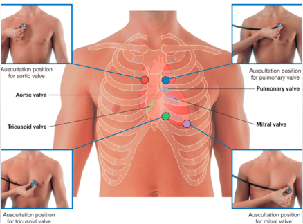 <ul><li><p>ask patient to take their shirt off</p></li><li><p>stethoscope switched to bell side</p></li><li><p>aortic - 2nd intercostal R sternal border</p></li><li><p>pulmonic - 2nd intercostal L sternal border</p></li><li><p>tricuspid - 4th/5th intercostal L sternal border</p></li><li><p>mitral - 5th intercostal midclavicular line</p></li><li><p><strong>report results to patient</strong></p></li></ul><p></p>