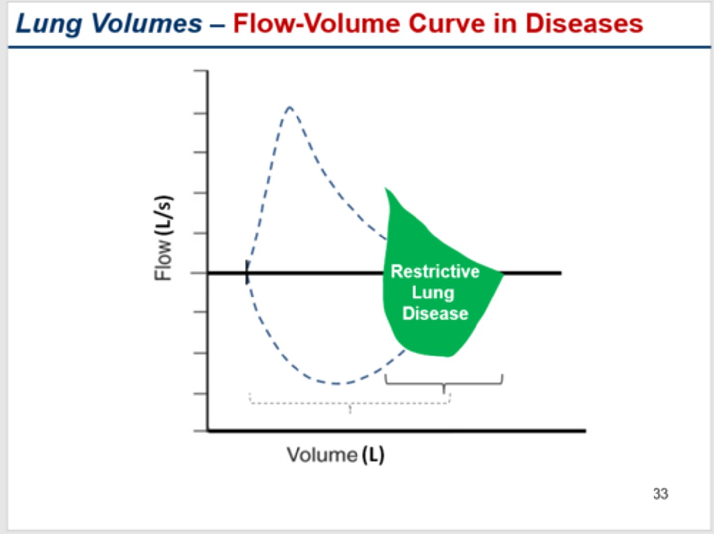 <p>- cannot inflate sufficiently --> severe volume limits --> shifts right</p><p>- smaller FVC</p><p>- normal PEF</p><p>- FEV1 will be impaired (bc of LOW FVC NOT airways resistance)</p><p>- FEV1/FVC ratio normal or high >0.7 >0.8 in severe cases bc fvc is so low</p><p>why?</p><p>1. very low compliance/high recoil</p>