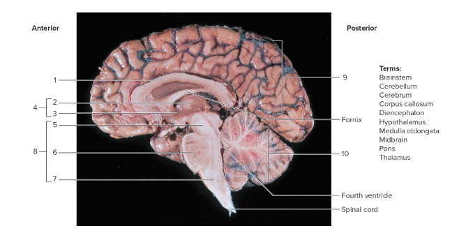 <p>Label the following: Sagittal section of the human brain</p>