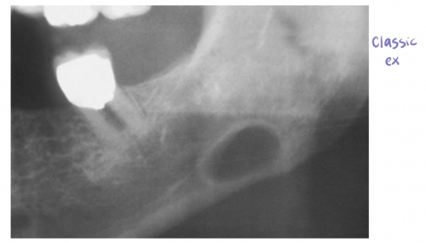 <p>true (no biopsy needed), can confirm dx with CT or MRI</p>