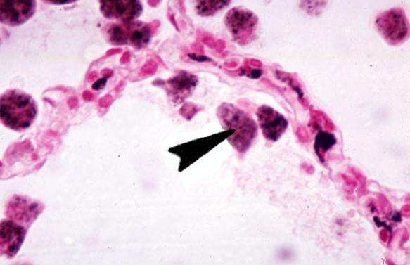 <p>Identify the numerous dust cells in this image.</p>