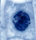 <ol><li><p><span>Chromatin fibres condense and coil to form chromosomes that will take up stain to be visible </span></p></li><li><p><span>The nuclear envelopes begins to dissolve/break down</span></p></li><li><p><span>Centrioles start moving to opposite ends of cell, forming spindle fibres</span></p></li></ol><p></p>