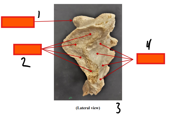 <p>lateral</p>