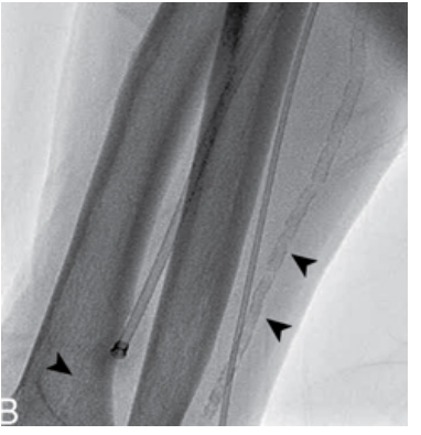 <p>what are these arrows pointing at</p>