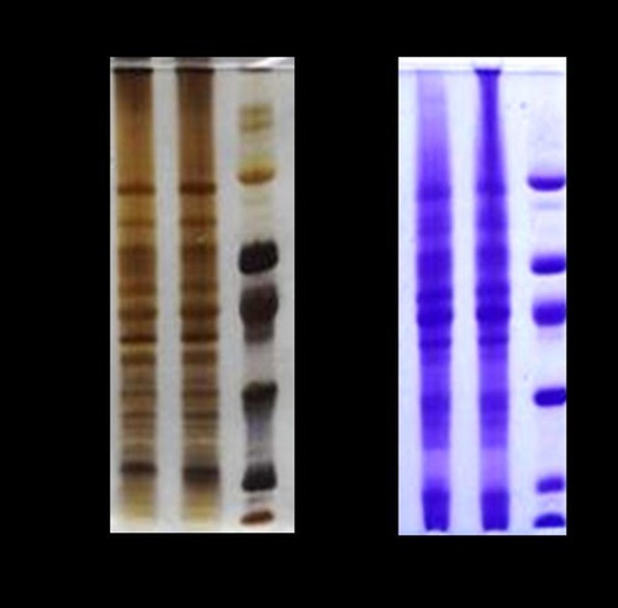<p>Technique for protein separation by molecular weight.</p>