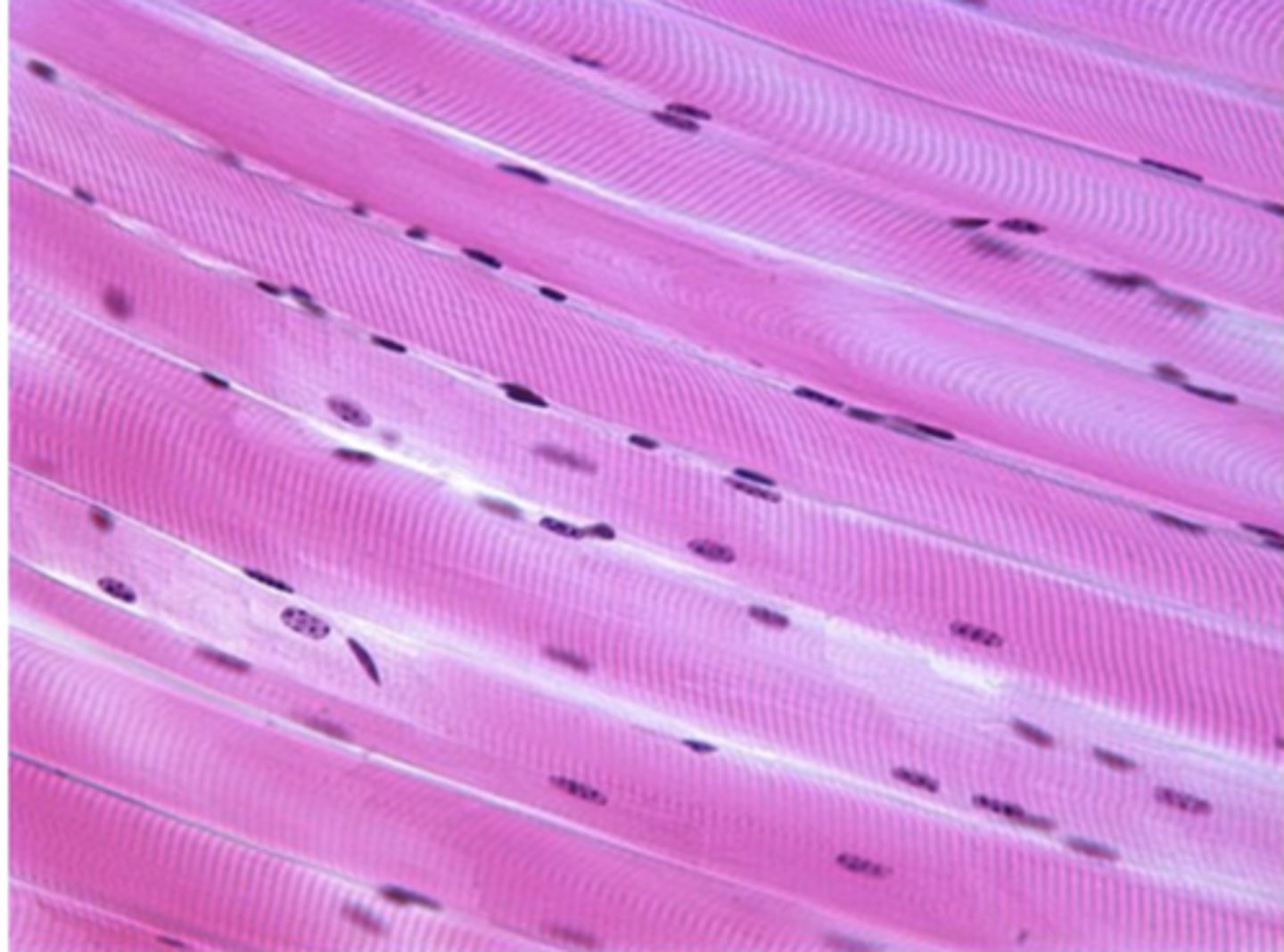 <p>A 40-year-old woman with a suspected disorder undergoes a muscle biopsy. The microscopic image, shown above demonstrates the tissue after processing and staining. Which of the following best describes this tissue biopsy?</p><p>A. Non-striated muscle with peripheral nuclei stained with hematoxylin and eosin</p><p>B. Non-striated muscle with a single, central nucleus stained with hematoxylin and eosin</p><p>C. Non-striated muscle with peripheral nuclei stained with Periodic acid-Schiff</p><p>D. Striated muscle with a single, central nucleus stained with hematoxylin and eosin</p><p>E. Striated muscle with peripheral nuclei stained with hematoxylin and eosin</p>