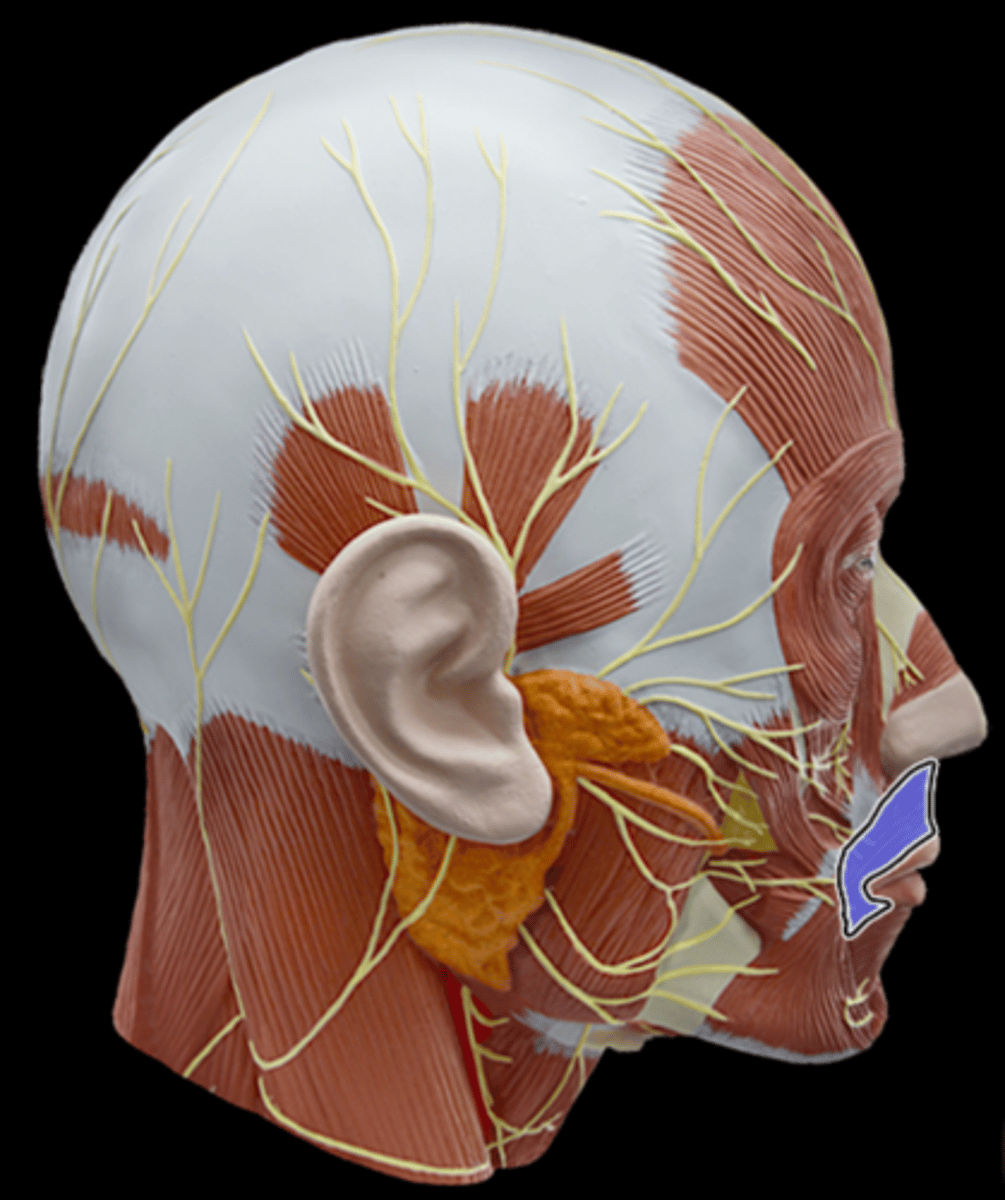 <p>What Muscle Is Highlighted?</p>