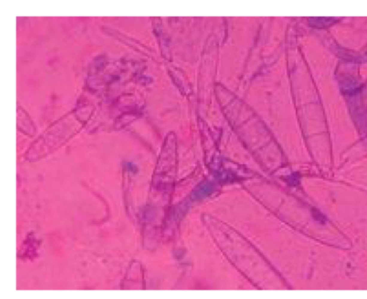 Identify this parasite.