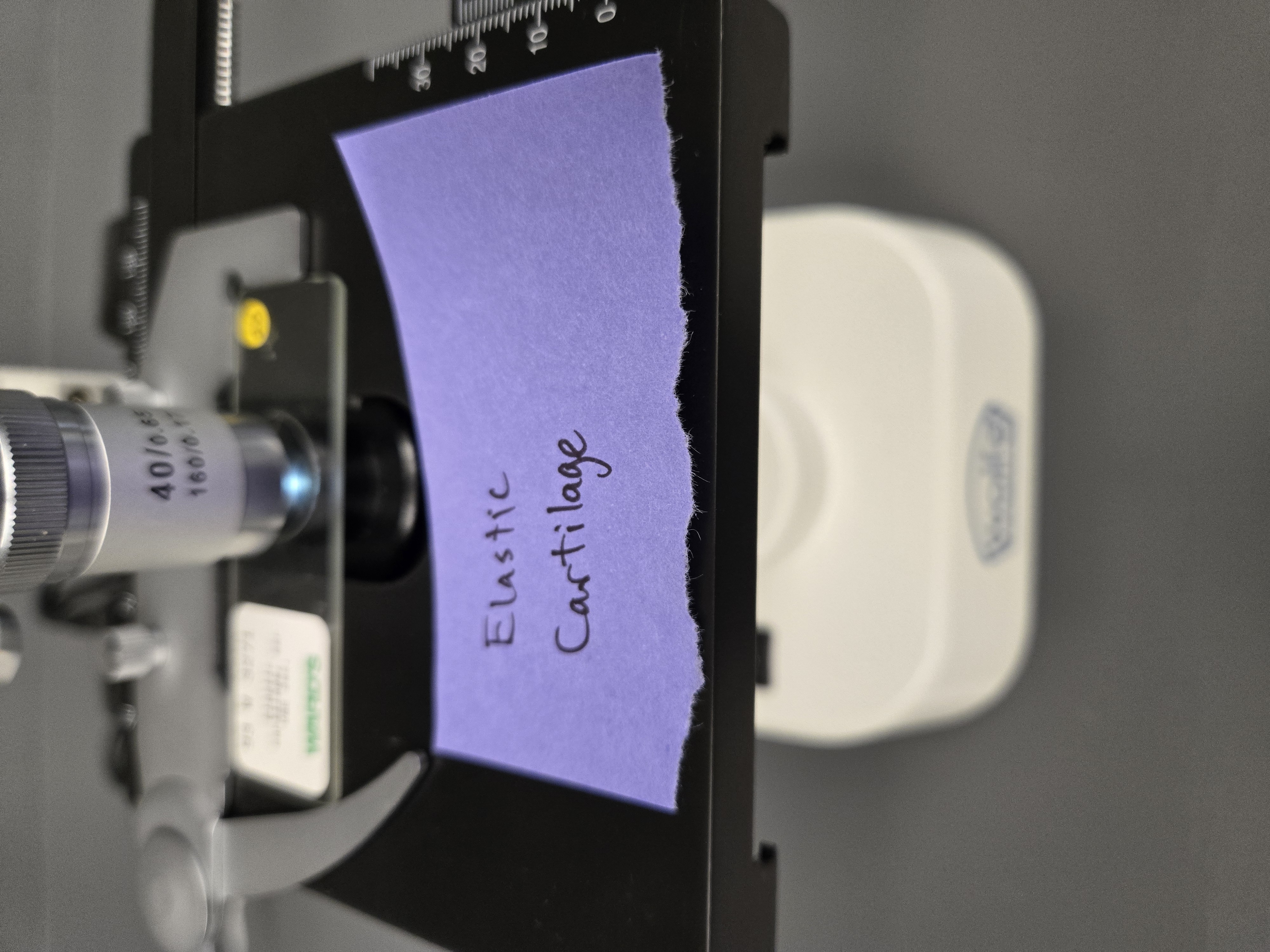 <p>Elastic cartilage</p><p><strong>Location</strong>:&nbsp;Epiglottis</p><p><strong>Function</strong>: Directs air and food to appropriate system&nbsp;</p>