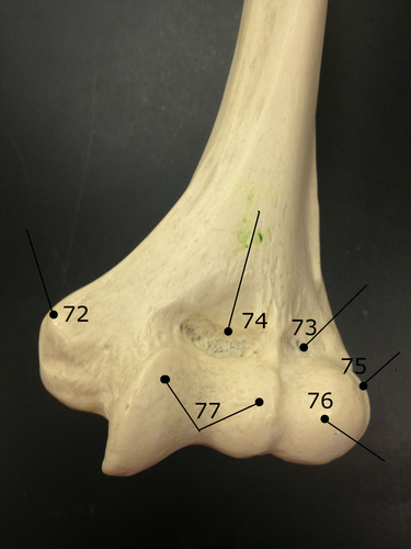 <p>Identify if this is an anterior or posterior view and if it is a right or left.</p>