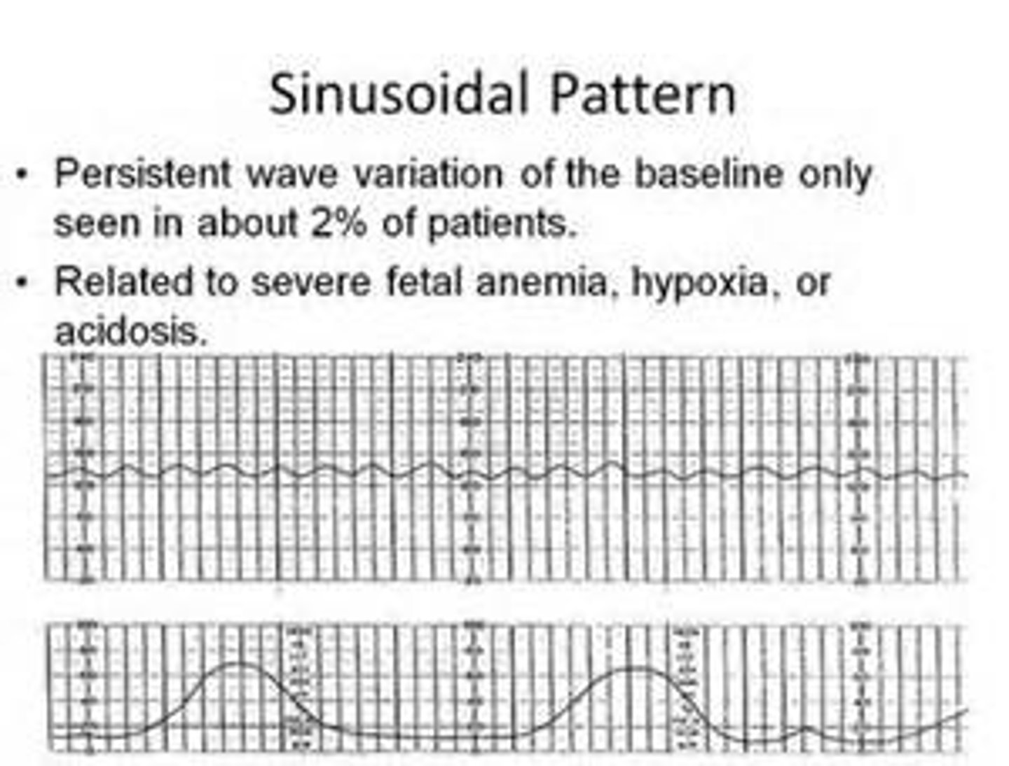 <p>dark red or port-wine bleeding</p><p>KNIFE-like pain</p><p>board like or rigid abdomen</p><p>fetal distress or absent FHT (SINUSOIDAL rhythm)</p>