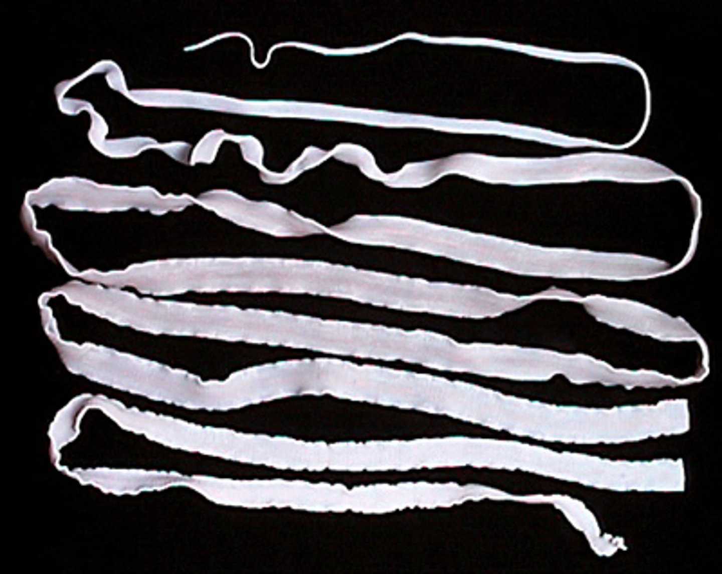 <p>What parasite is this if it is from a cat</p>