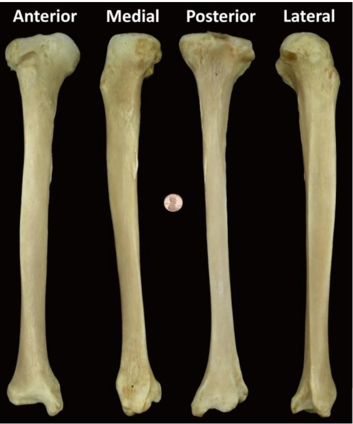 <p>what bone is this?</p>