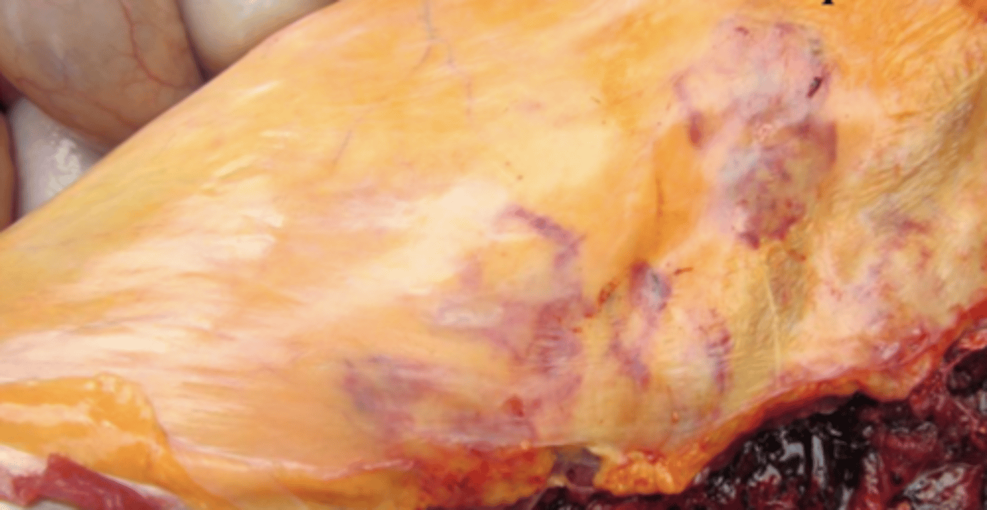 <p>¿etiología?</p>