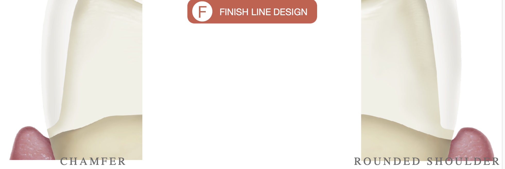 <ul><li><p>chamfer </p></li><li><p>rounded shoulder </p></li></ul><p></p>
