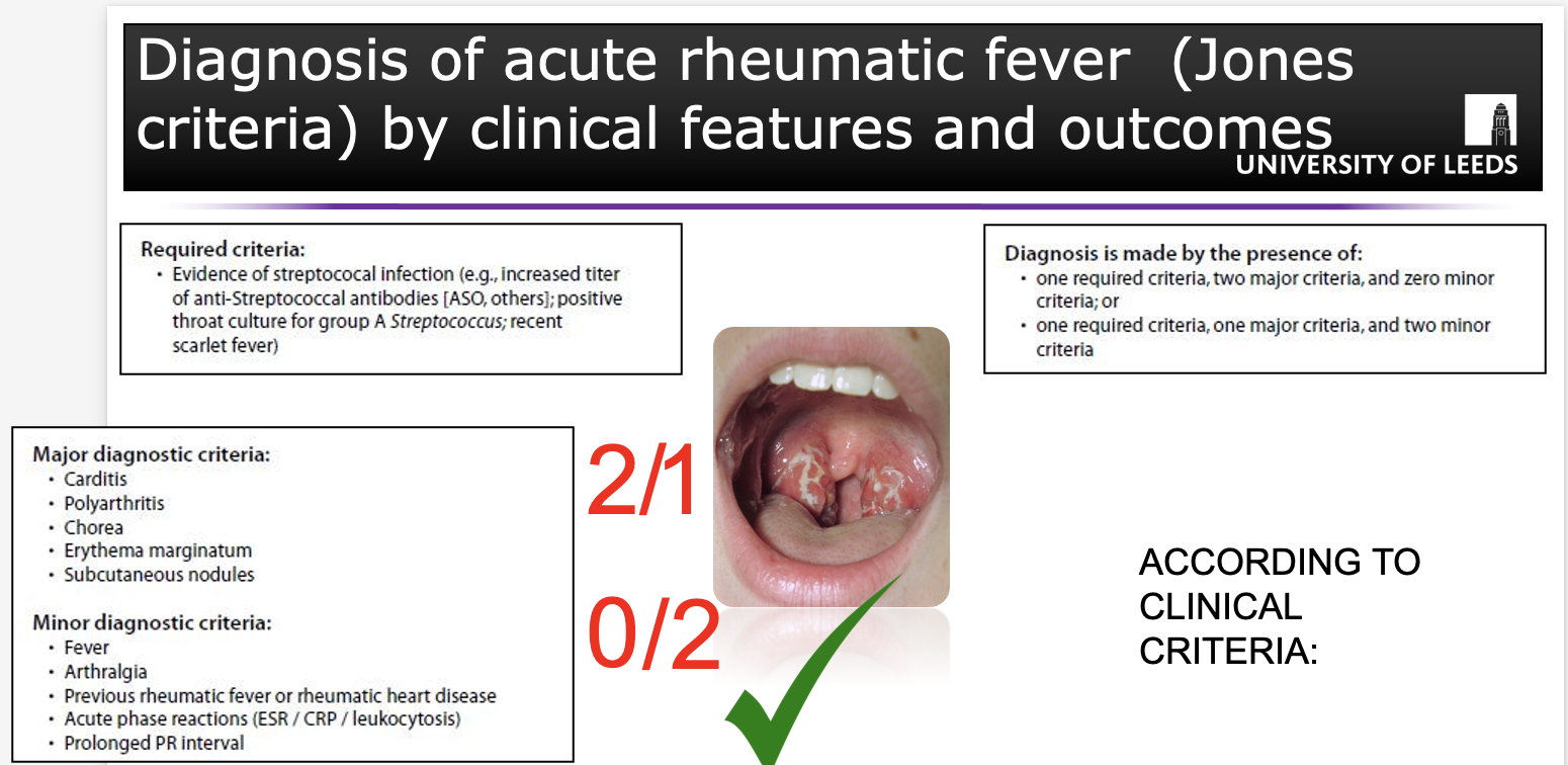 <p><strong>Presence of streptococcal infection</strong>- look for <strong>streptococcal antibodies</strong> or do a <strong>throat swab.</strong></p>