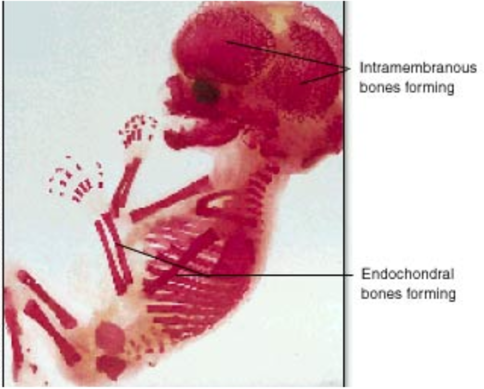 1. The process of forming bones within a membrane 
2. Forms
- Flat bones
- Bones of the skull 
- Clavicle
- Maxillae
- Zygomatic mandible 