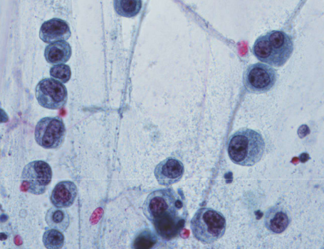 term image