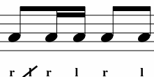 <p>What Variation is This? </p>