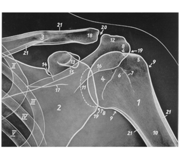 <p>Extremitas acromialis</p>