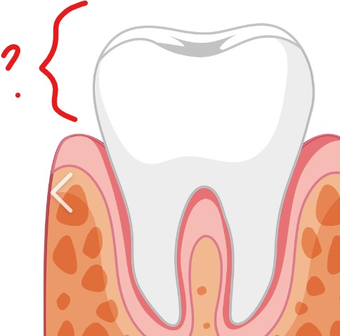 <p>Buccal View</p>