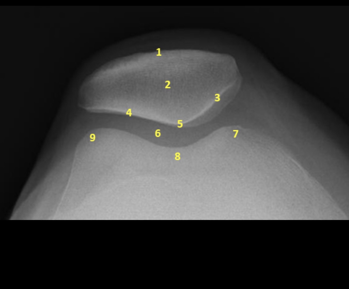 <p>Label the image.</p>