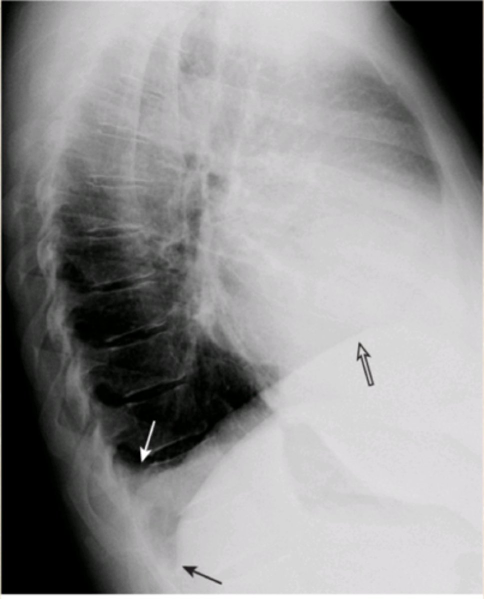 <p>Diagnosis?</p>