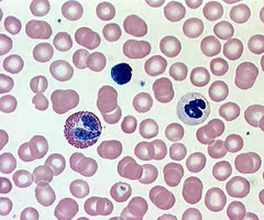 <p>fluid extracellular matrix used to <strong>transport substances </strong>throughout the body filled with blood cells</p>