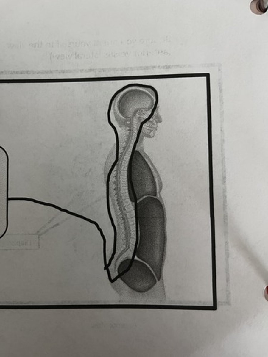 <p>Which cavity does this picture represent?</p>