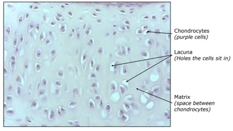 <p>What tissue is shown</p>