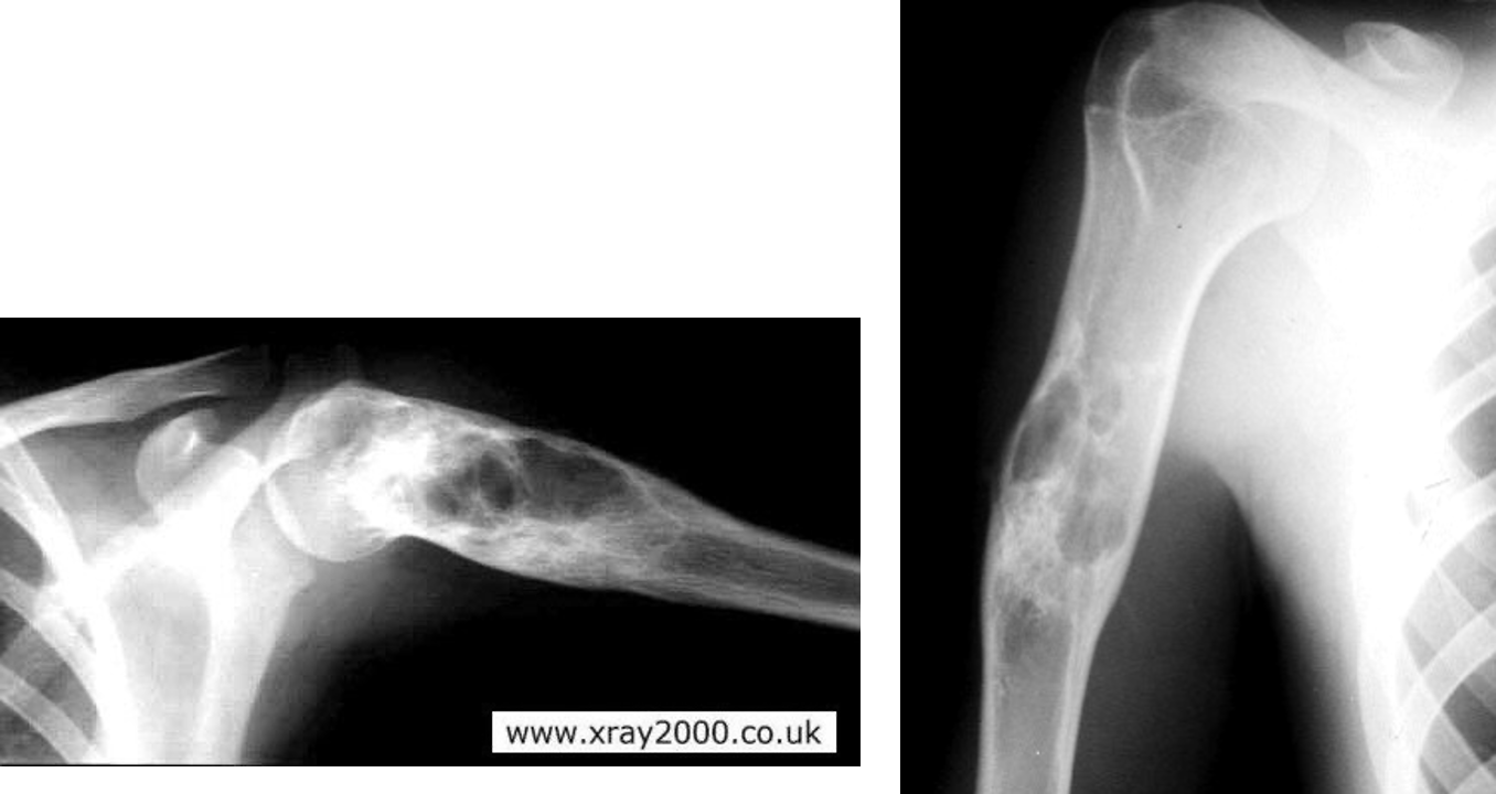 <p>humerus</p>