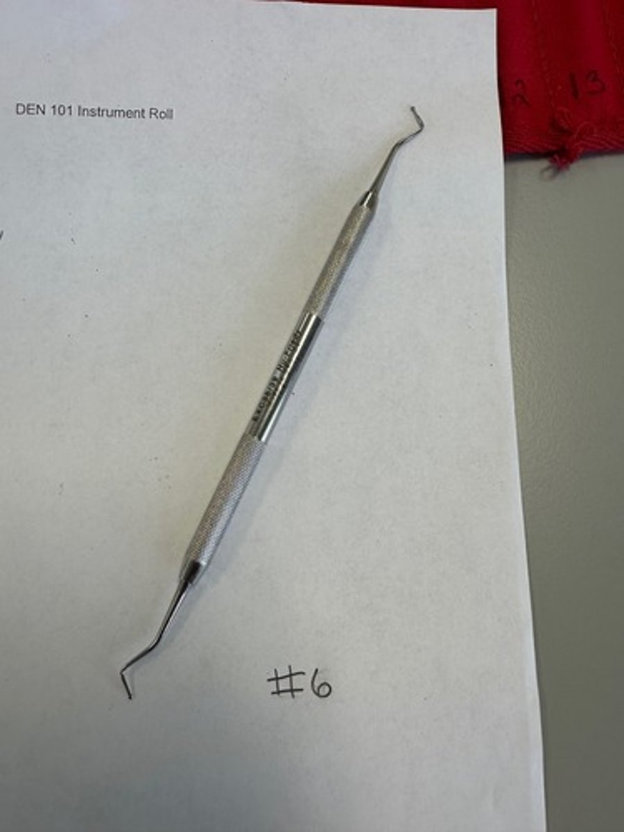<p>Removal of soft dentin, debris, and decay from the tooth (hand manual cutting instruments)</p>