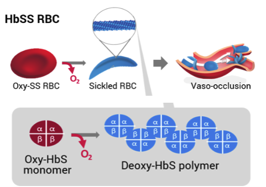<p>formation of<strong> deoxy-HbS-polymer</strong> → distorting the RBC shape </p>