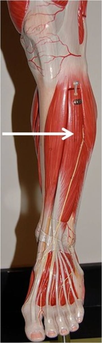 <p>Action: dorsiflexes foot</p>