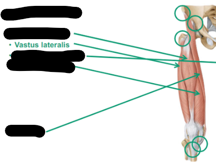<p>Describe Vastus Lateralis thigh muscle </p>