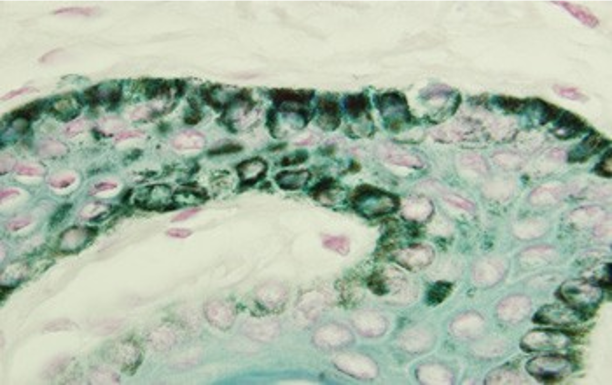 term image